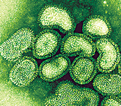 Autoridades de EEUU insta a eliminar el consumo preventivo de Tamiflu