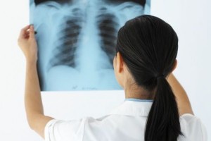 El índice de cáncer de pulmón entre la gente que se identifica a sí misma como hispana es más bajo que el de los blancos en los Estados Unidos. Sin embargo, algunos hispanos que presentan cáncer de pulmón pueden tener dificultad en conseguir la atención médica apropiada. Como otras minorías étnicas, muchos hispanos se enfrentan a obstáculos para los cuidados de salud, como lo son las barreras del idioma y la falta de seguro médico.