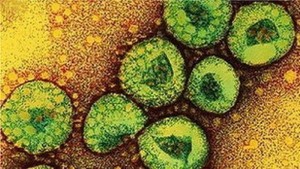 El síndrome respiratorio coronavirus de Oriente Medio (MERS-CoV) ha causado enfermedad grave y muerte en personas de varios países. El 11 de mayo del 2014, se confirmó el segundo caso en un viajero que llegó a los Estados Unidos.