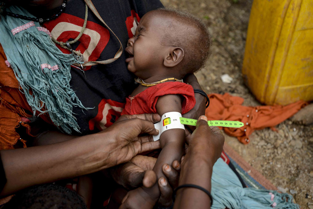 Empeoramiento de crisis de hambruna aumenta migración global: ONU